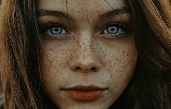 Frau mit Sommersprossen